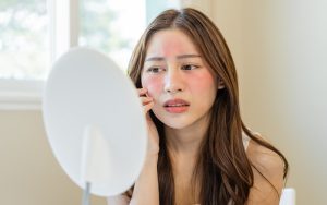 Managing Rosacea: Medication and Lifestyle Adjustments