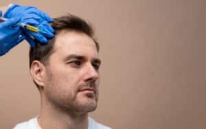 Regain Confidence: PRP Hair Treatment Breakthroughs in the UK