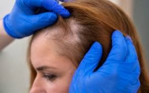 GFC vs. PRP: Which One’s Made For?