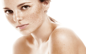 Everything You Need to Know About Faux Freckle Tattoos