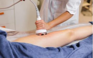 Sofwave Laser Skin Treatment: A Revolutionary Approach to Skin Rejuvenation