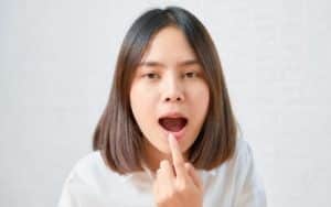 The Truth Behind Oral Markings: What Are Those Lines in Your Mouth?