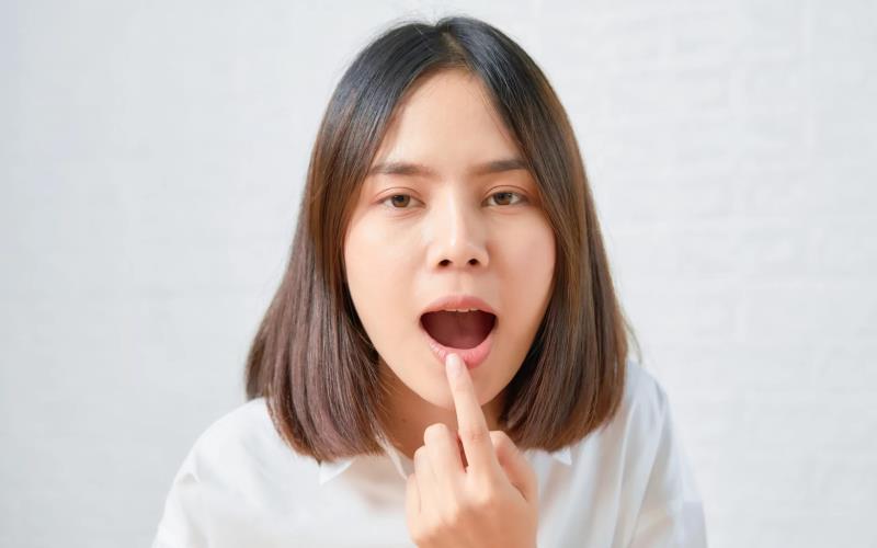 The Truth Behind Oral Markings: What Are Those Lines in Your Mouth?