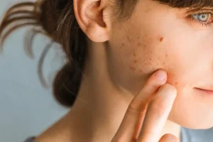 How Hormonal Changes Impact Skin and How to Support Repair Naturally