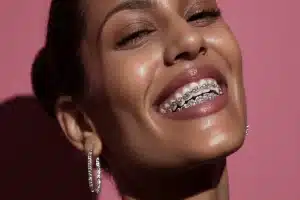 How to Clean Grillz: Keep Your Bling Sparkling