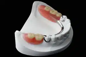 Dentures After the Age of 60